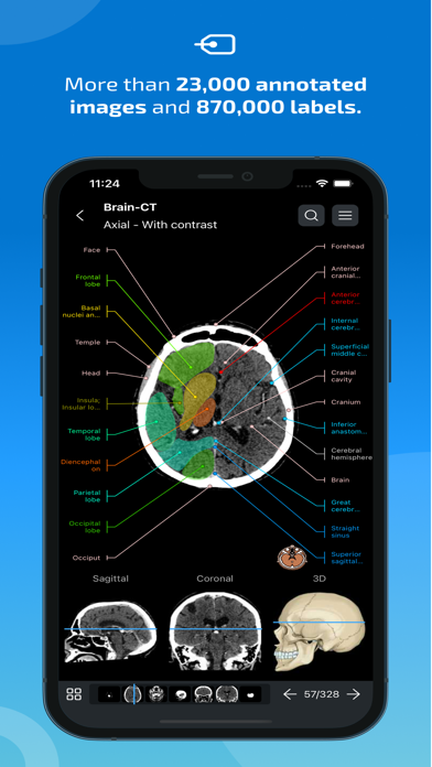 IMAIOS e-Anatomy App Store screenshot 2