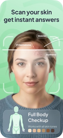 Rash ID: Skin Rash Identifier App Store screenshot 1