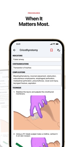 palmEM AI: EM Quick Reference App Store screenshot 2