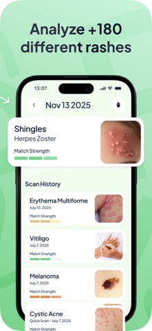 Rash ID: Skin Rash Identifier App Store screenshot 2