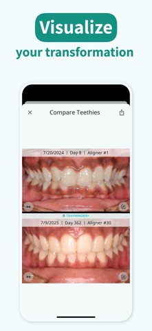 TrayMinder: Aligner Timer App Store screenshot 2