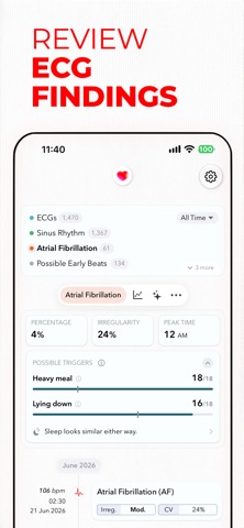 ECG+ | Your Watch ECG Reader App Store screenshot 2