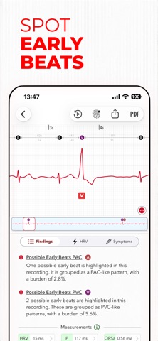 ECG+ | Your Watch ECG Reader App Store screenshot 1