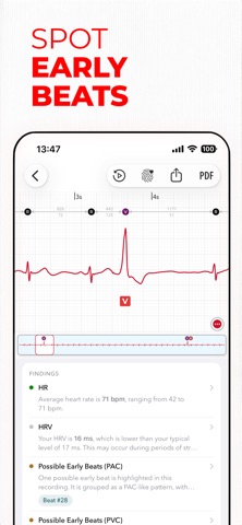 ECG+ | Your Watch ECG Reader App Store screenshot 1